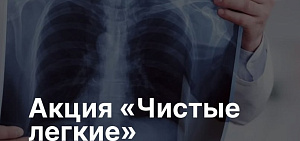 Ярославцев пригласили на профилактическое флюорографическое обследование легких